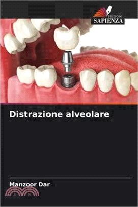 Distrazione alveolare