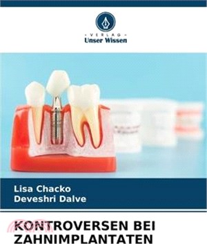 Kontroversen Bei Zahnimplantaten
