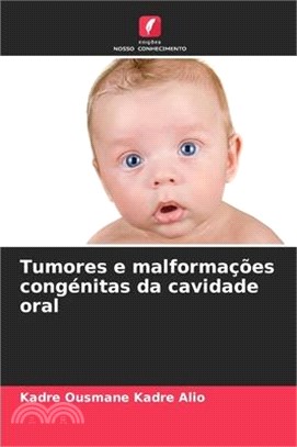 Tumores e malformações congénitas da cavidade oral