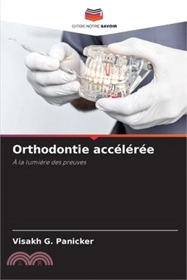 Orthodontie accélérée