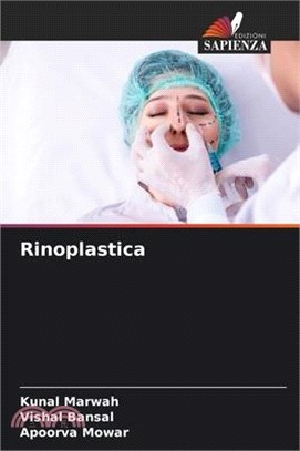 Rinoplastica