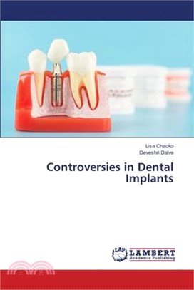 Controversies in Dental Implants