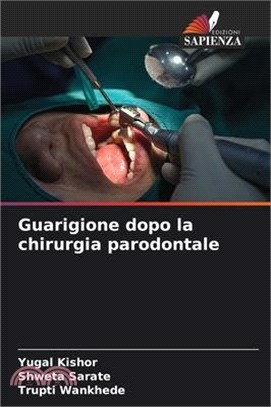 Guarigione dopo la chirurgia parodontale