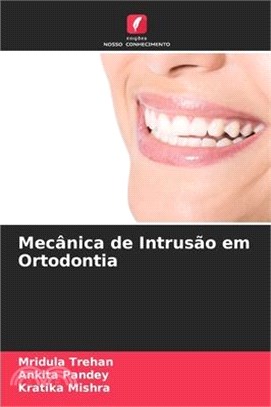 Mecânica de Intrusão em Ortodontia