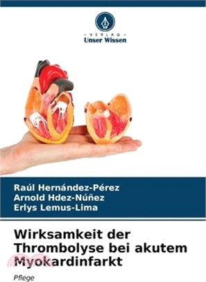 Wirksamkeit der Thrombolyse bei akutem Myokardinfarkt