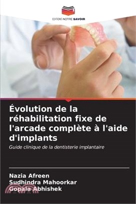 Évolution de la réhabilitation fixe de l'arcade complète à l'aide d'implants