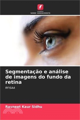 Segmentação e análise de imagens do fundo da retina