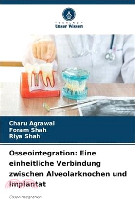 Osseointegration: Eine einheitliche Verbindung zwischen Alveolarknochen und Implantat