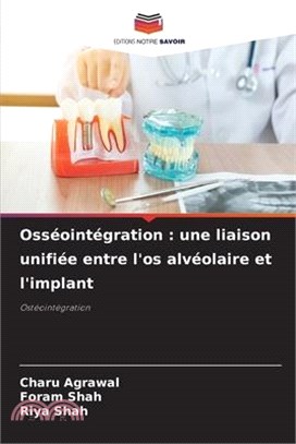 Osséointégration: une liaison unifiée entre l'os alvéolaire et l'implant