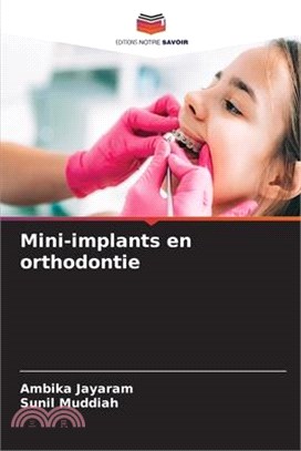 Mini-implants en orthodontie