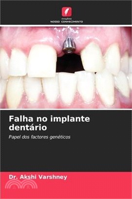 Falha no implante dentário