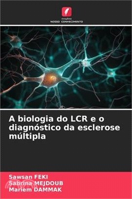 A biologia do LCR e o diagnóstico da esclerose múltipla