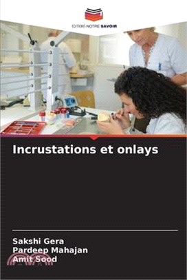 Incrustations et onlays