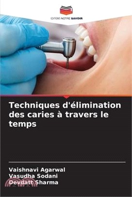 Techniques d'élimination des caries à travers le temps