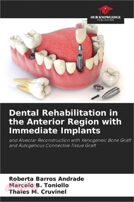 Dental Rehabilitation in the Anterior Region with Immediate Implants