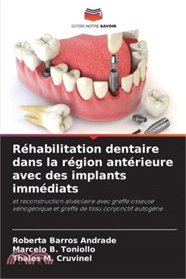 Réhabilitation dentaire dans la région antérieure avec des implants immédiats