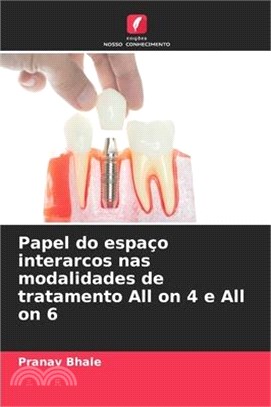 Papel do espaço interarcos nas modalidades de tratamento All on 4 e All on 6