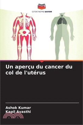 Un aperçu du cancer du col de l'utérus