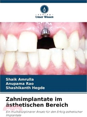Zahnimplantate im ästhetischen Bereich