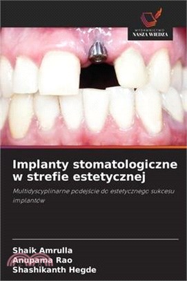 Implanty stomatologiczne w strefie estetycznej
