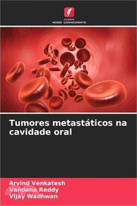 Tumores metastáticos na cavidade oral