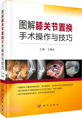 圖解膝關節置換手術操作與技巧（簡體書）