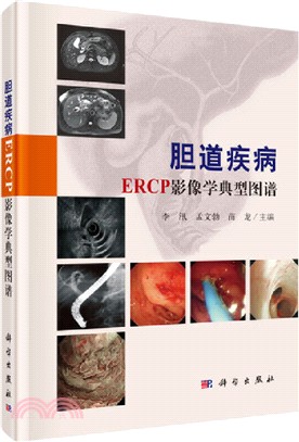 膽道疾病ERCP影像學典型圖譜（簡體書）