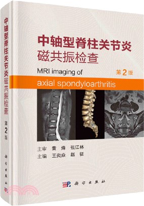 中軸型脊柱關節炎磁共振檢查(第2版)（簡體書）