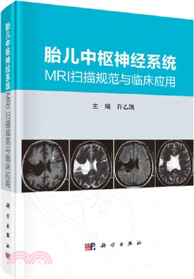 胎兒中樞神經系統MRI掃描規範與臨床應用（簡體書）