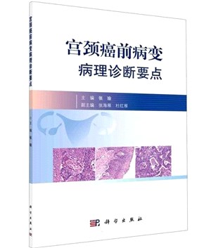 宮頸癌前病變病理診斷要點（簡體書）