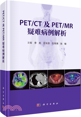 PET/CT及PET/MR疑難病例解析（簡體書）