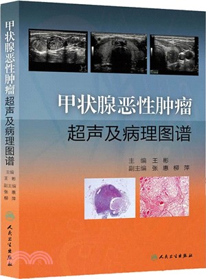 甲狀腺惡性腫瘤超聲及病理圖譜（簡體書）