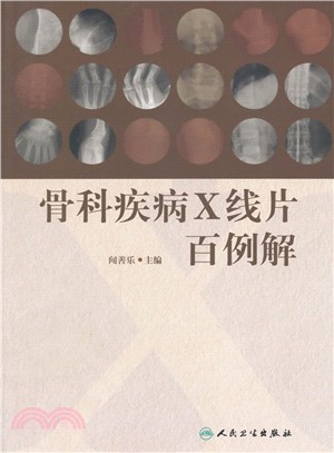 骨科疾病X線片百例解（簡體書）