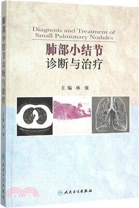 肺部小結節診斷與治療（簡體書）
