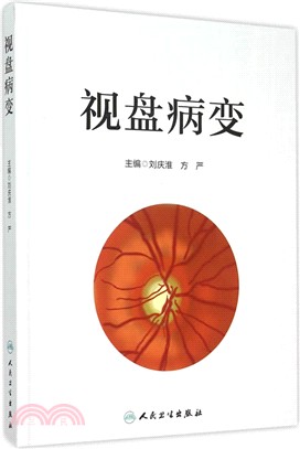 視訊光碟病變（簡體書）