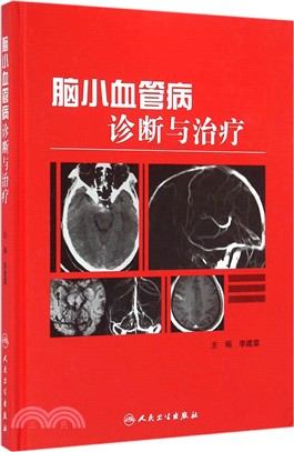 腦小血管病診斷與治療（簡體書）