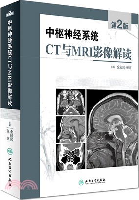 中樞神經系統CT和MRI影像解讀(第二版)（簡體書）