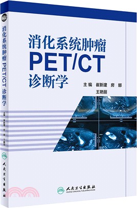 消化系統腫瘤PET/CT診斷學（簡體書）