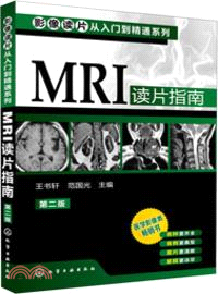 MRI讀片指南(第二版)（簡體書）