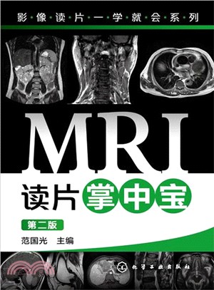 MRI讀片掌中寶(第2版)（簡體書）