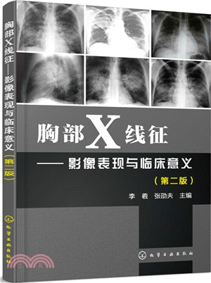 胸部X線征：影像表現與臨床意義(第2版)（簡體書）