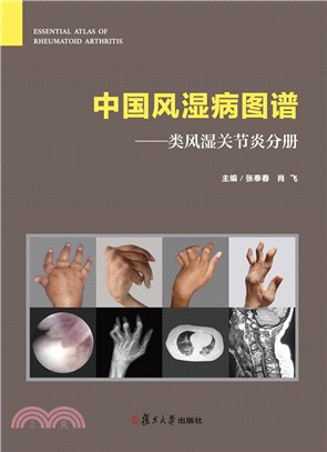 中國風濕病圖譜：類風濕關節炎分冊（簡體書）