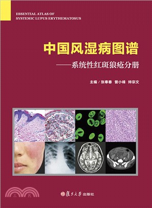中國風濕病圖譜：系統性紅斑狼瘡分冊（簡體書）