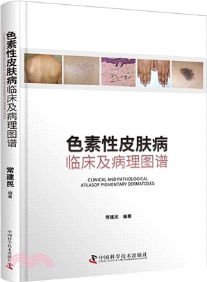 色素性皮膚病：臨床及病理圖譜（簡體書）