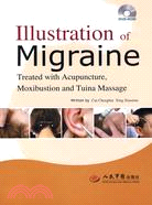 Illustration of Migraine(偏頭痛針灸推拿治療圖解)（簡體書）