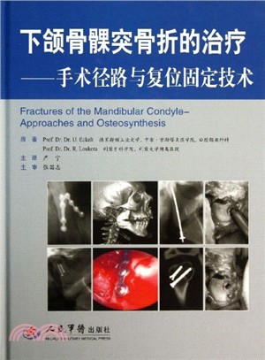 下頜骨髁突骨折的治療：手術徑路與複位固定技術（簡體書）
