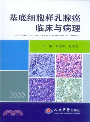 基底細胞樣乳腺癌臨床與病理（簡體書）