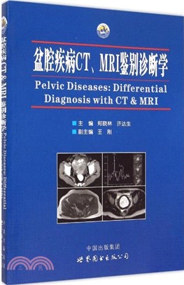 盆腔疾病CT、MRI鑒別診斷學（簡體書）
