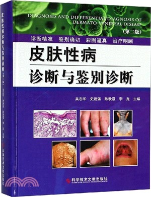 皮膚性病診斷與鑒別診斷(第2版)（簡體書）