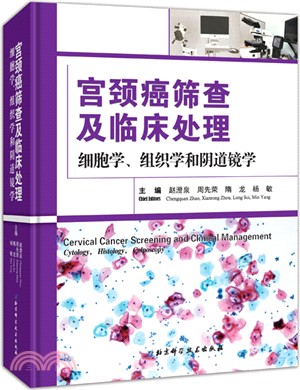 宮頸癌篩查及臨床處理：細胞學、組織學和陰道鏡學（簡體書）